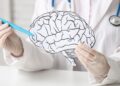Why Brain Injuries Lead to Some of the Highest Personal Injury Settlements