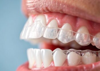 Your Guide to Modern Orthodontic Options for a Confident Smile