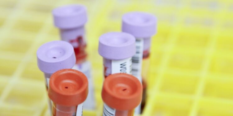 How Routine Blood Tests Can Boost Your Wellness Journey