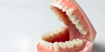 Modern Dentures, Modern Confidence: How Today’s Technology Is Redefining the Perfect Smile