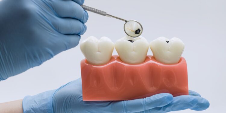 How Lifestyle Choices Impact Oral Health in Palestine, TX