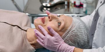 Deep Plane Facelift Recovery: What to Expect Week by Week