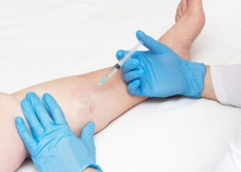 Non-Surgical Treatments for Vein Disease: What Patients Should Know