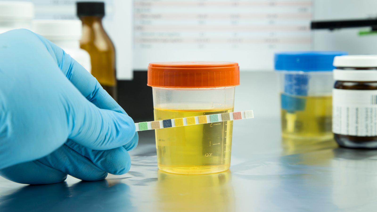 Why Drug Screening Infrastructure Matters More Than Ever in Modern Clinical
Research