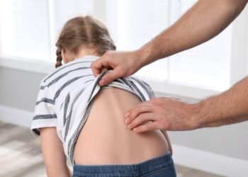 Shaping A New Future: The Latest Breakthroughs In Scoliosis Care