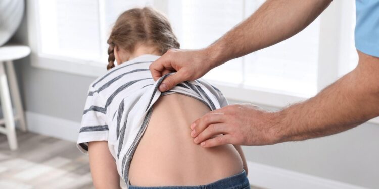 Shaping A New Future: The Latest Breakthroughs In Scoliosis Care
