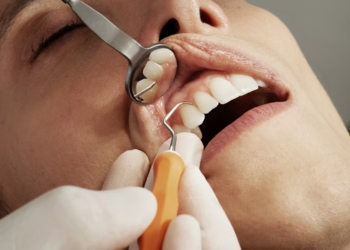 The Surprising Connection Between Oral Health and Whole-Body Wellness