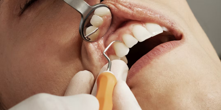 The Surprising Connection Between Oral Health and Whole-Body Wellness