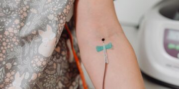 Sequoia Zanubrutinib: Key Clinical Insights for First-Line CLL Management