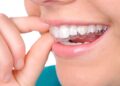 Retainer Materials: Why Holding Teeth in Place Needs a Different Approach
