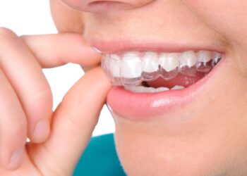 Retainer Materials: Why Holding Teeth in Place Needs a Different Approach