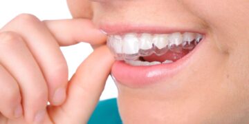 Retainer Materials: Why Holding Teeth in Place Needs a Different Approach