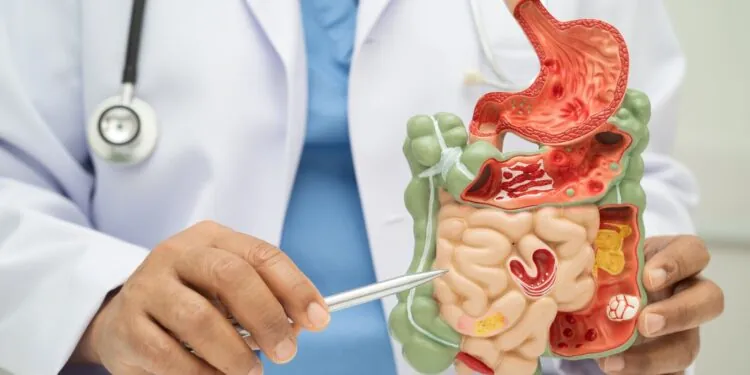 How Do Prebiotics Support Digestive Health?