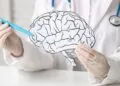 Why Brain Injuries Lead to Some of the Highest Personal Injury Settlements